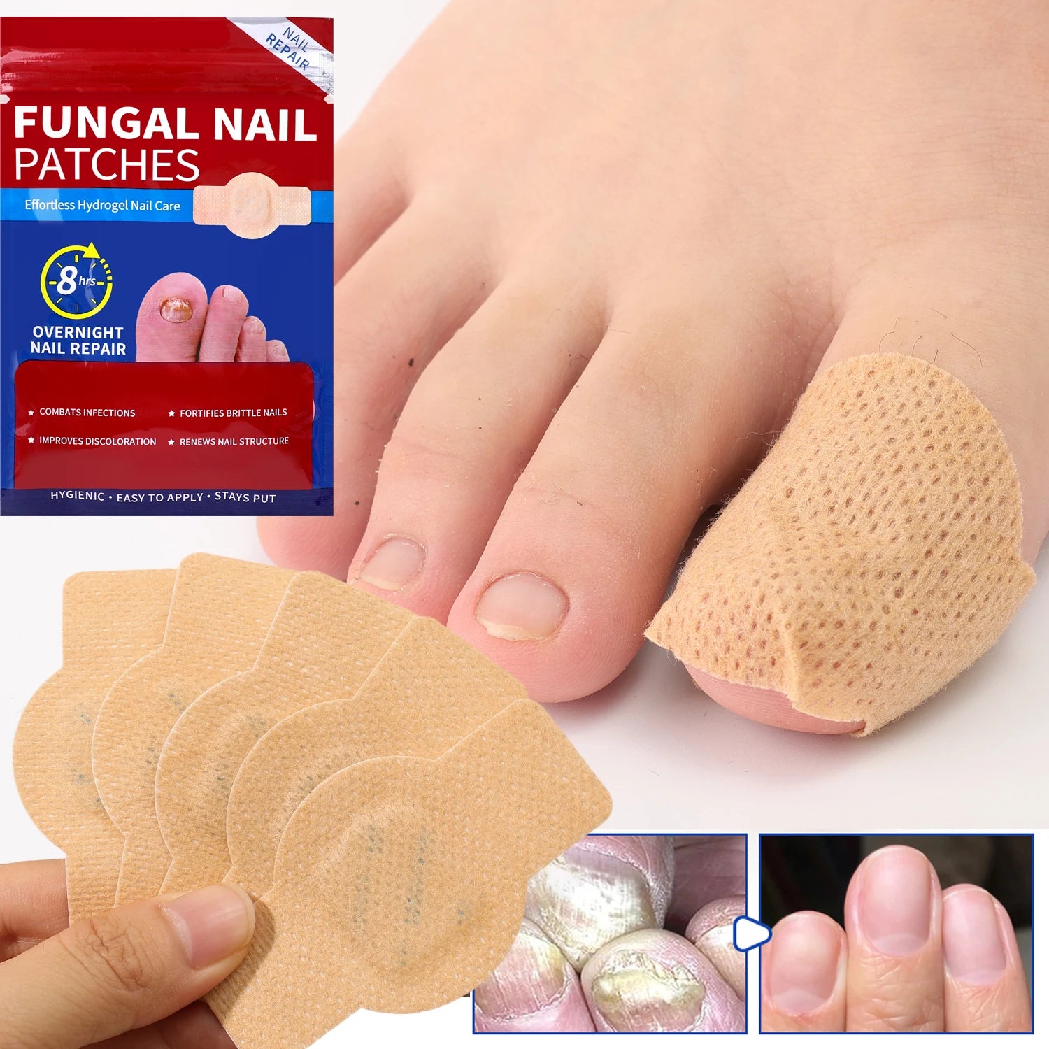 NailCure - Eliminates nail fungus in 3 weeks