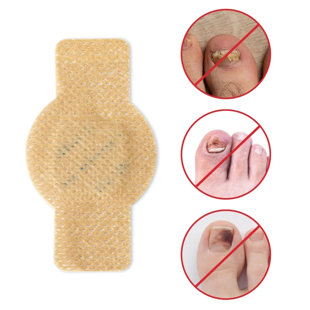 Adhesivo para uñas con hongos y dañadas | Resistente al agua y eficaz